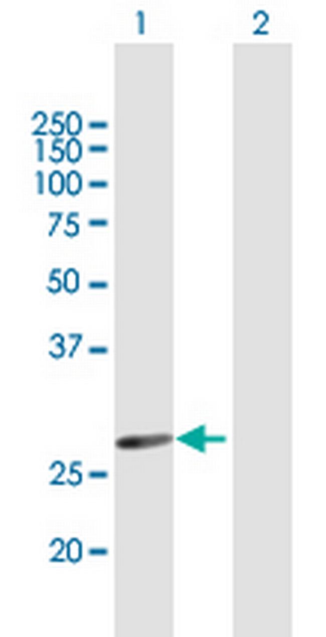 HSD17B3 Antibody in Western Blot (WB)