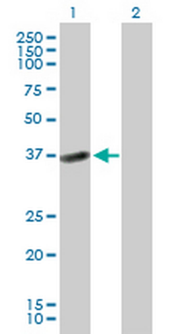 HSD17B2 Antibody in Western Blot (WB)