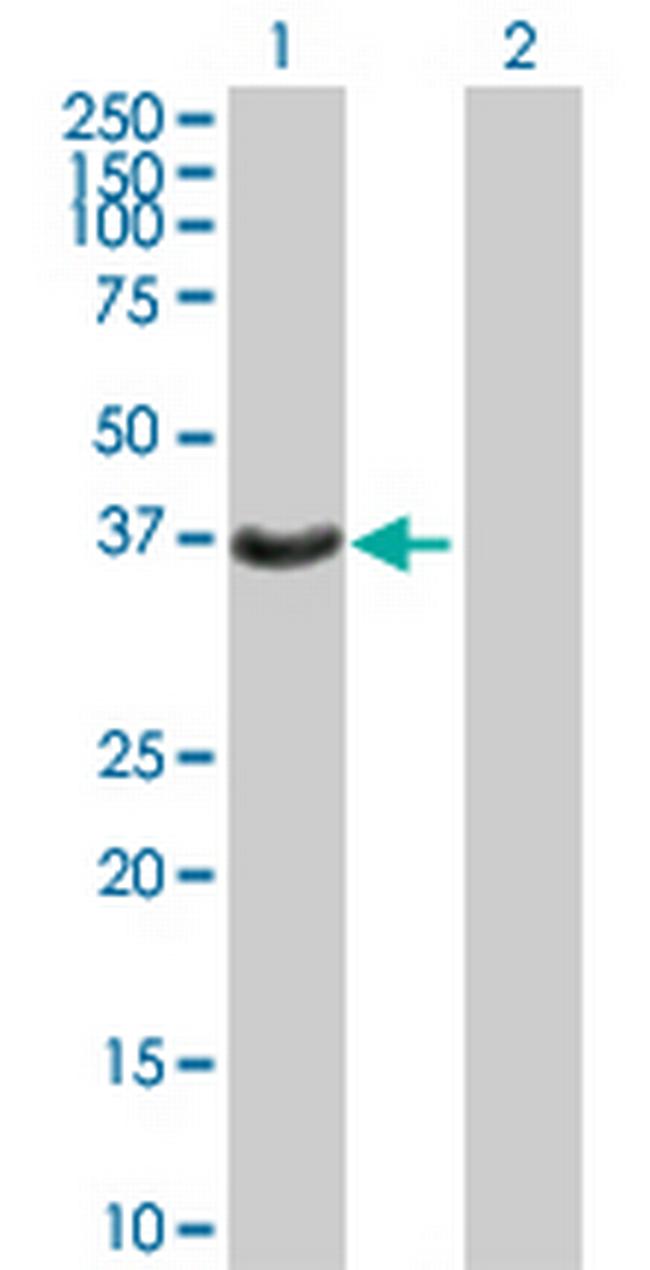HSD17B2 Antibody in Western Blot (WB)