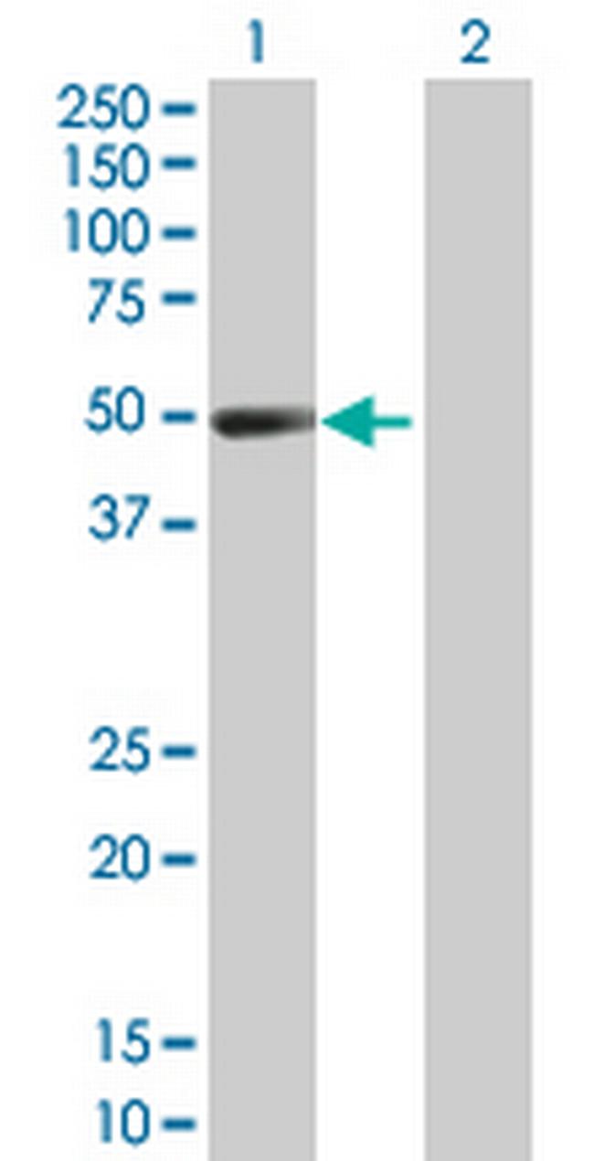 HSF4 Antibody in Western Blot (WB)