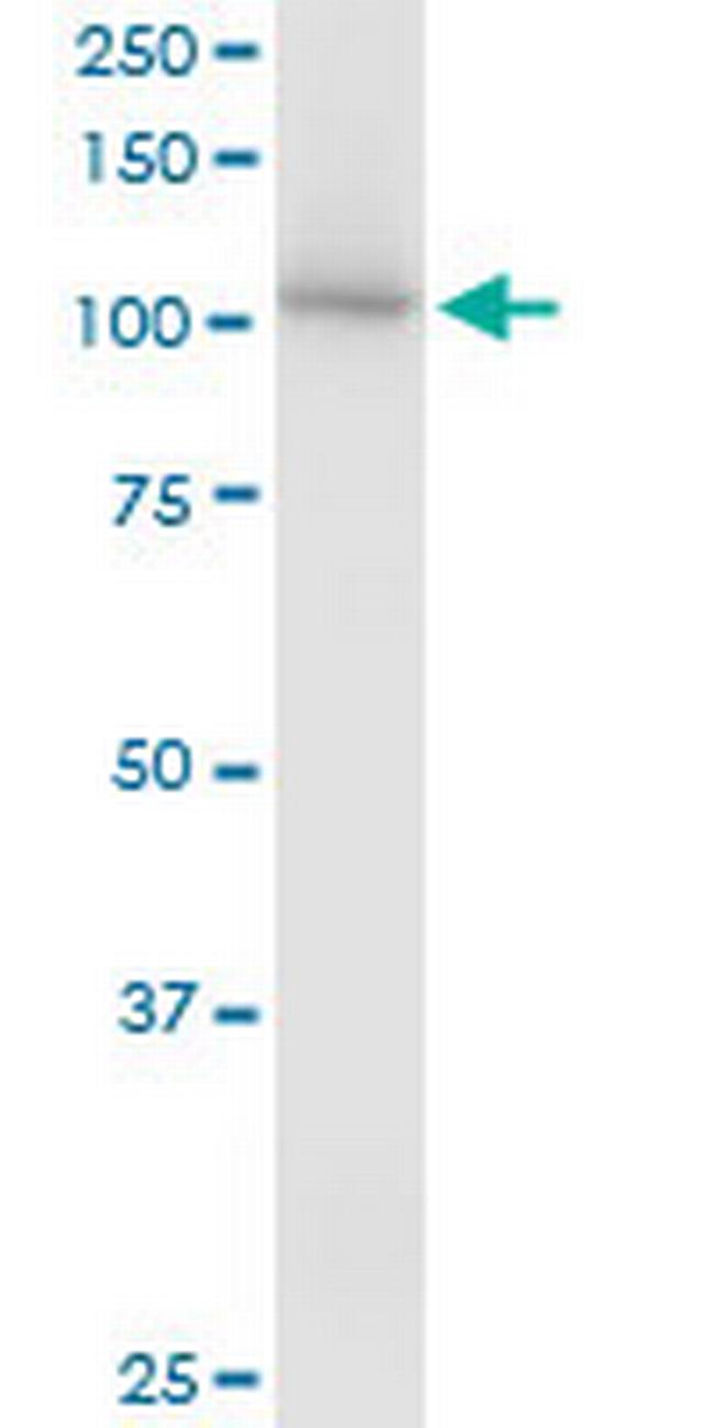 HSPA4 Antibody in Western Blot (WB)