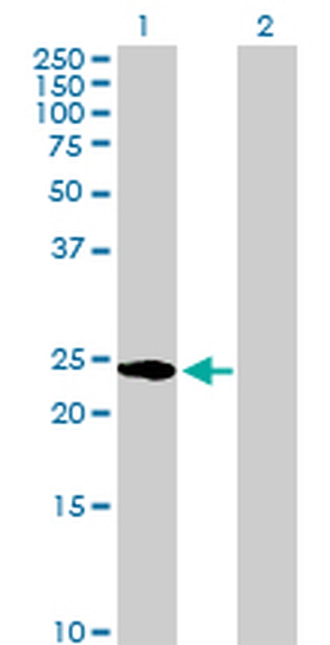 HSPB1 Antibody in Western Blot (WB)
