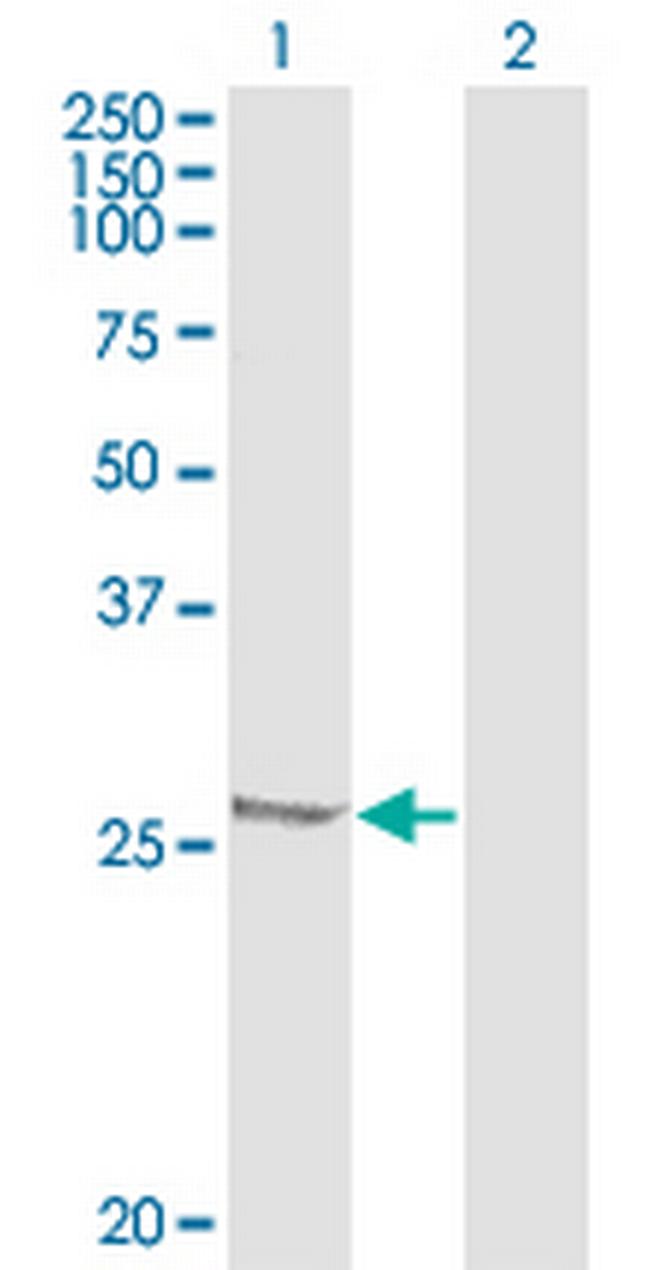 HSPB1 Antibody in Western Blot (WB)