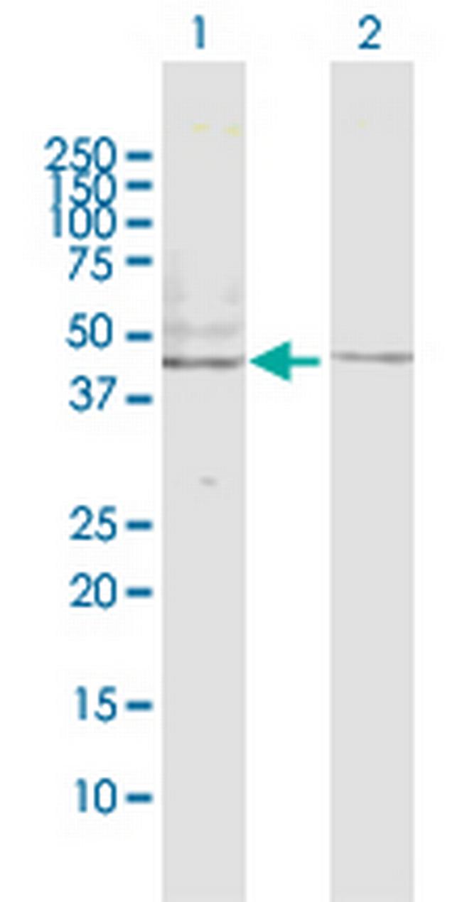 HTR2B Antibody in Western Blot (WB)