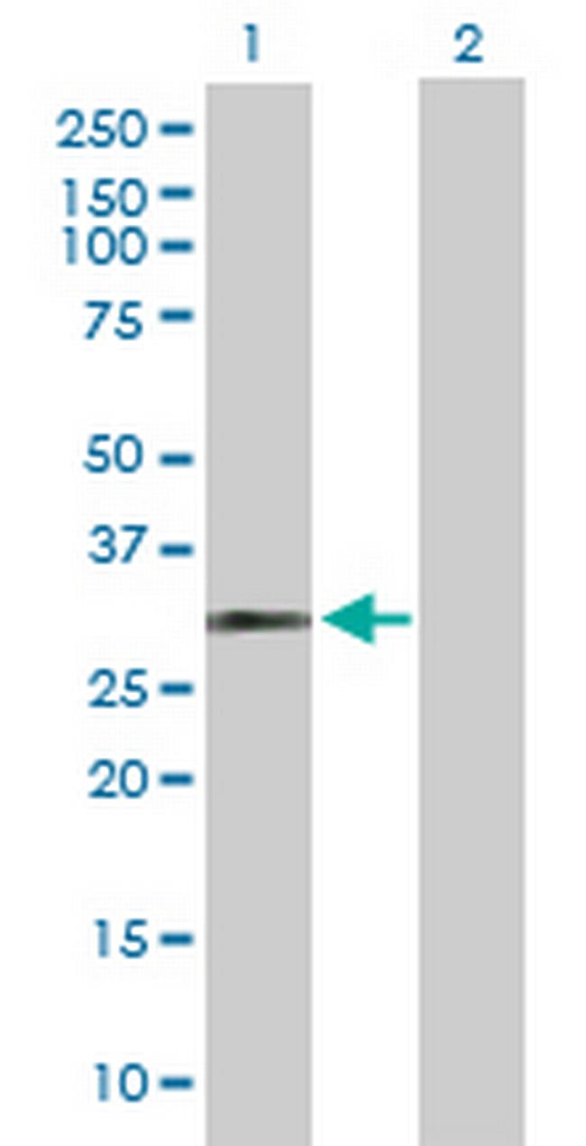 HUS1 Antibody in Western Blot (WB)