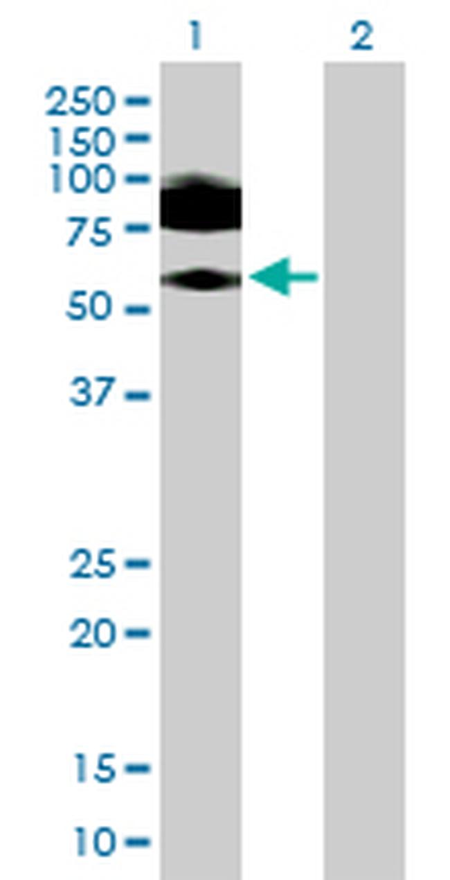 ICAM1 Antibody in Western Blot (WB)