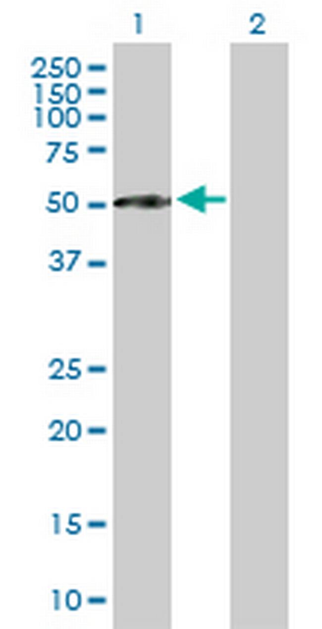 CFI Antibody in Western Blot (WB)