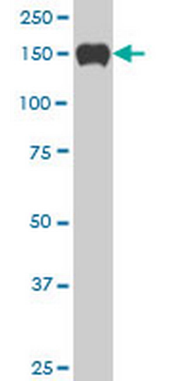 SP110 Antibody in Western Blot (WB)