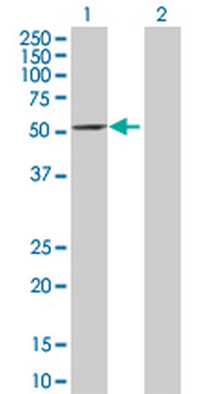 IFIT2 Antibody in Western Blot (WB)