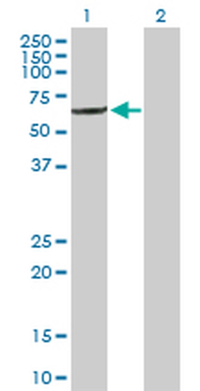 IFIT1 Antibody in Western Blot (WB)