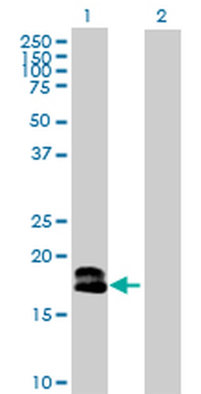 IFNA1 Antibody in Western Blot (WB)