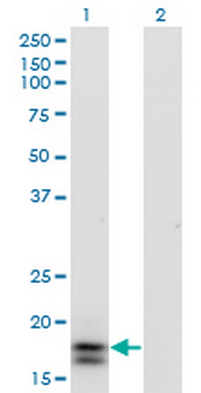 IFNA2 Antibody in Western Blot (WB)