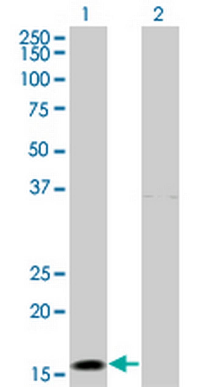 IFNA2 Antibody in Western Blot (WB)