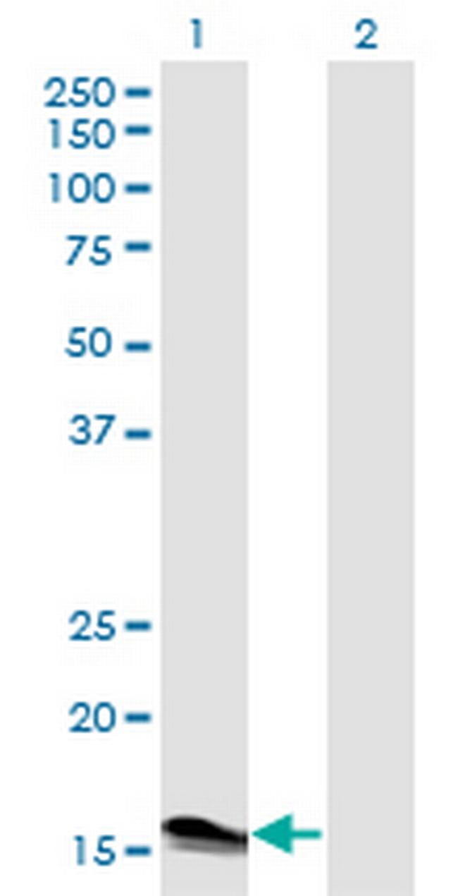 IFNA2 Antibody in Western Blot (WB)