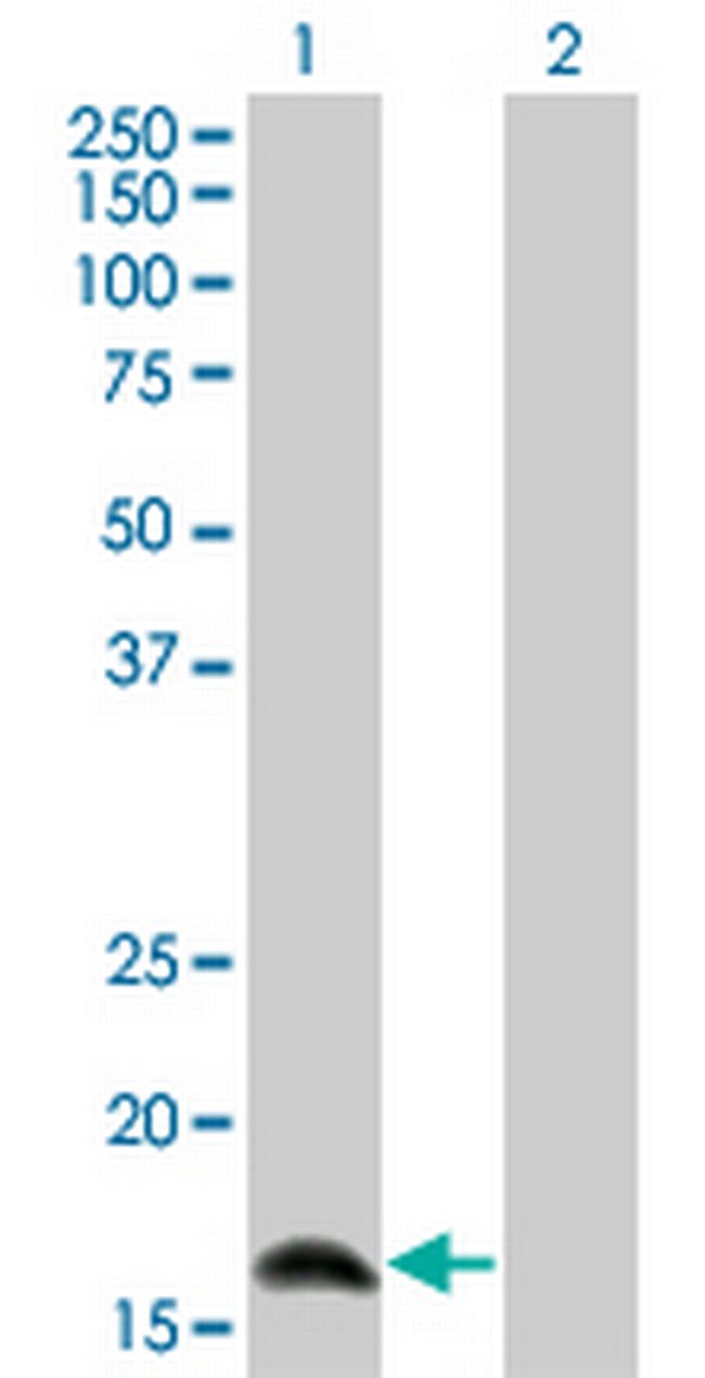 IFNA2 Antibody in Western Blot (WB)