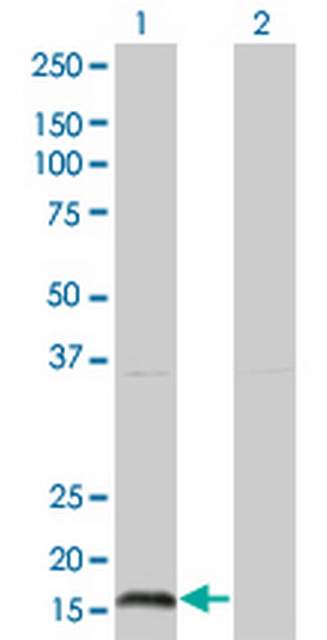 IFNA2 Antibody in Western Blot (WB)