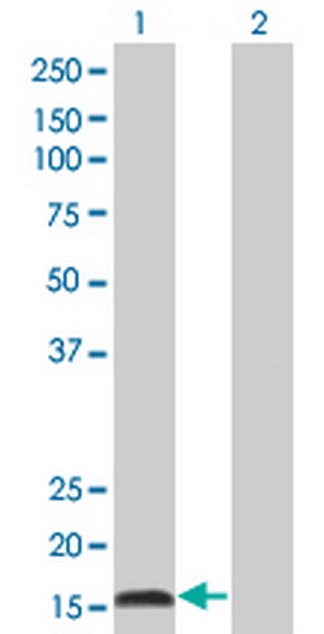IFNA2 Antibody in Western Blot (WB)