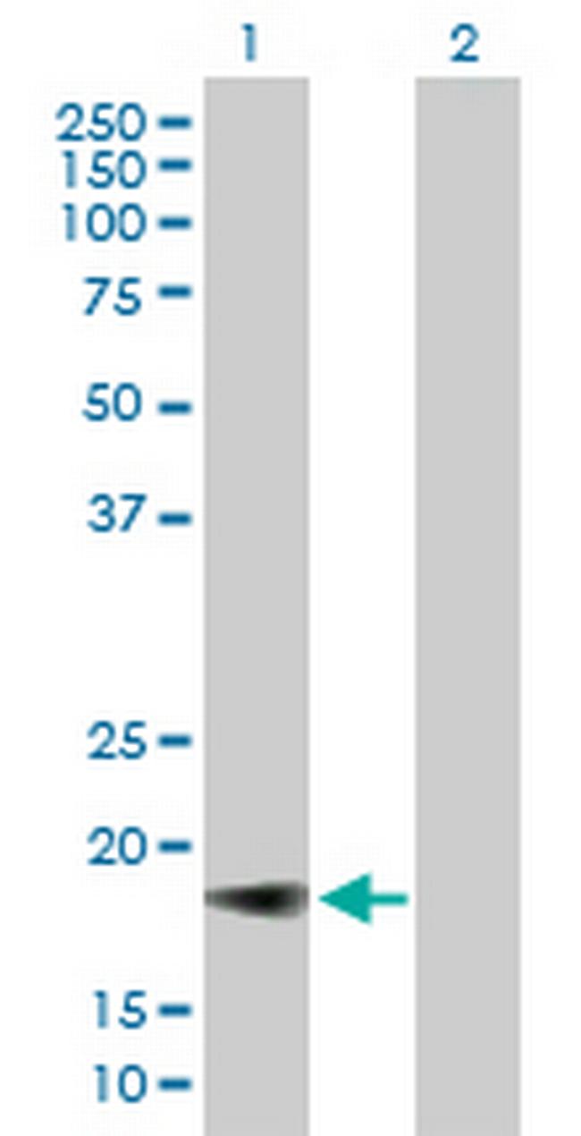 IFNA5 Antibody in Western Blot (WB)