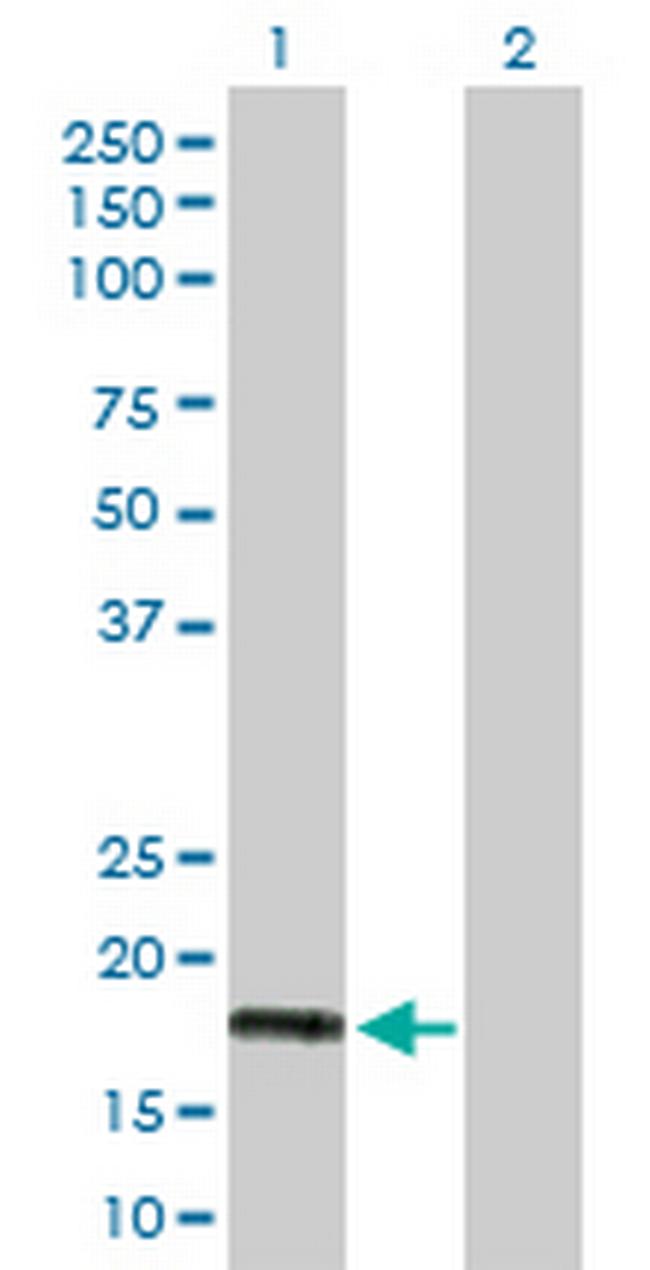 IFNA5 Antibody in Western Blot (WB)
