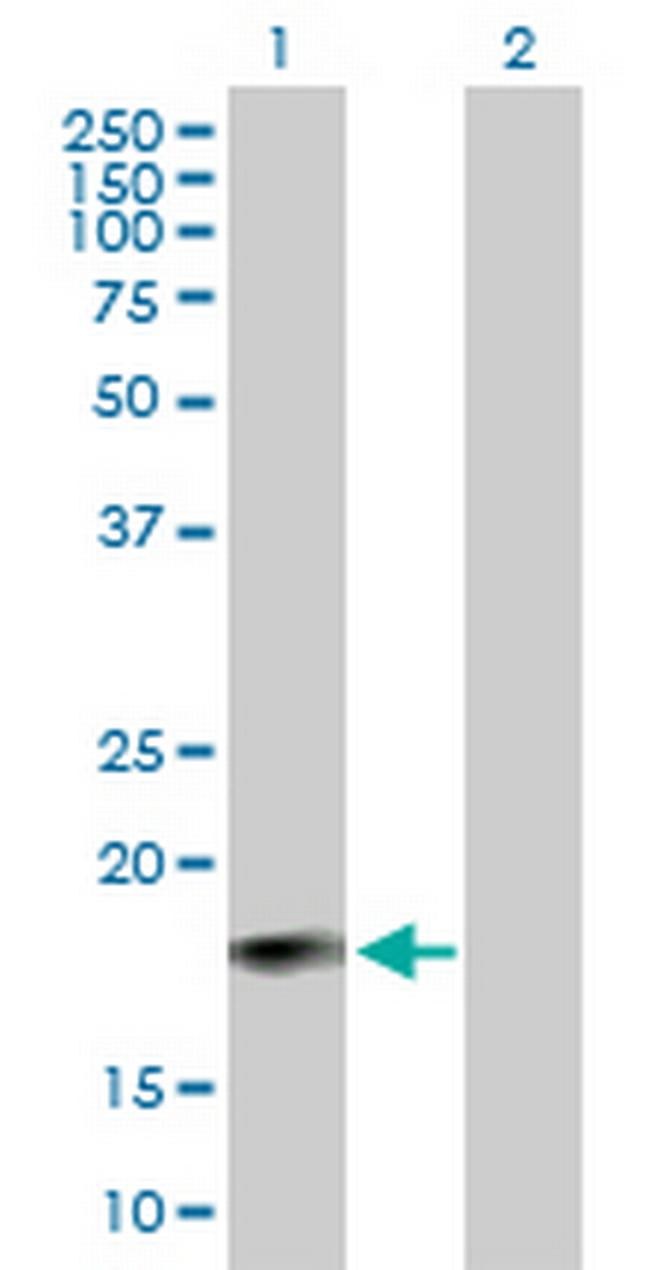 IFNA6 Antibody in Western Blot (WB)