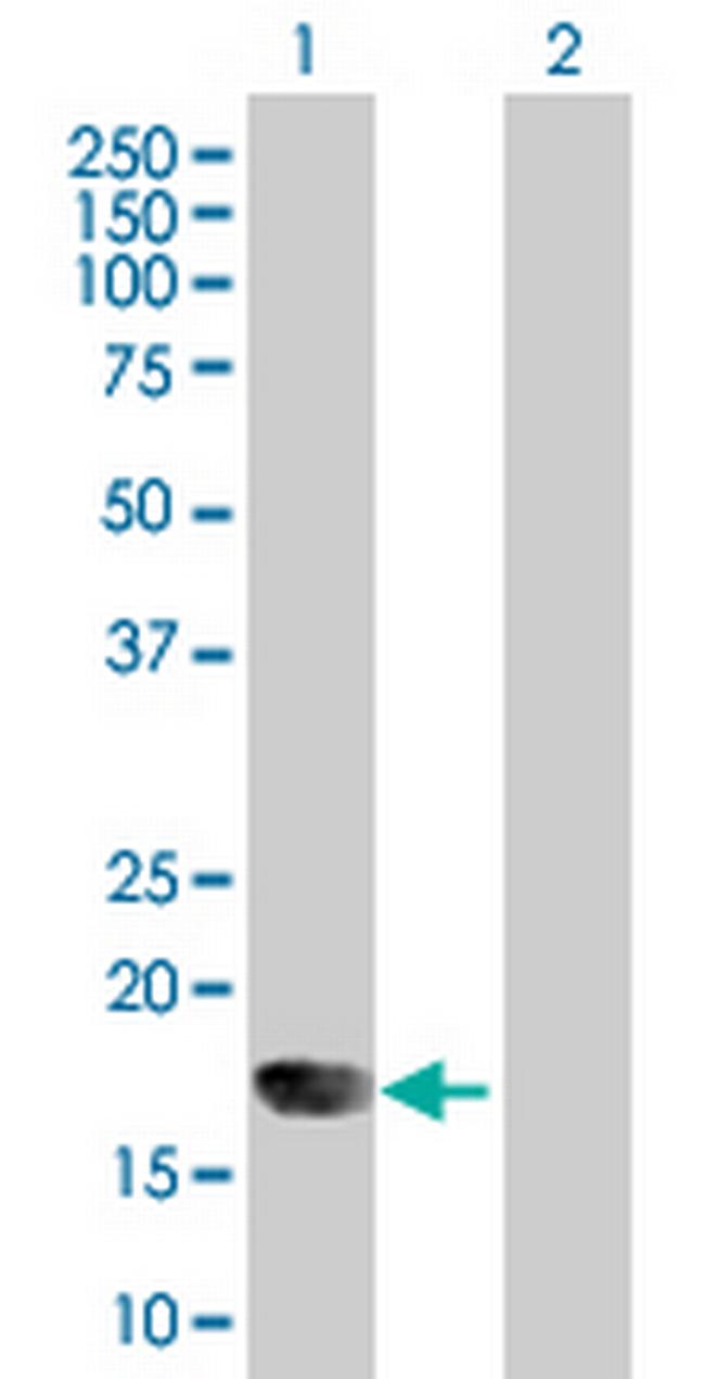IFNA6 Antibody in Western Blot (WB)