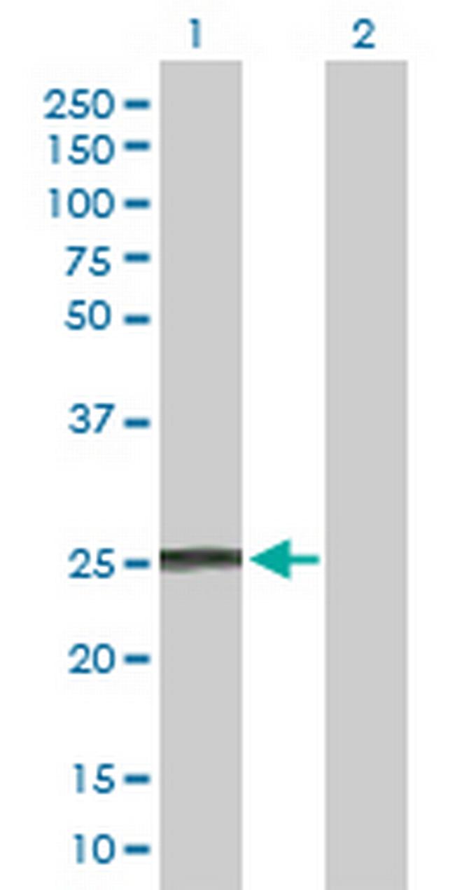 IFNA8 Antibody in Western Blot (WB)