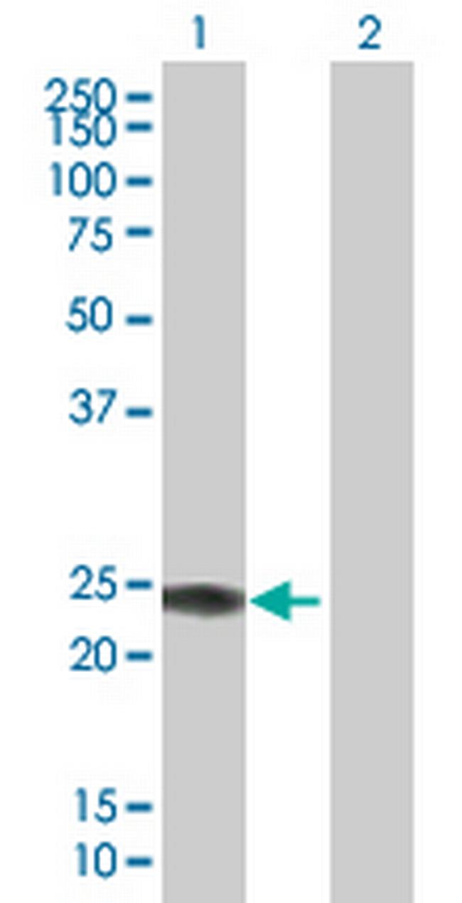 IFNA14 Antibody in Western Blot (WB)