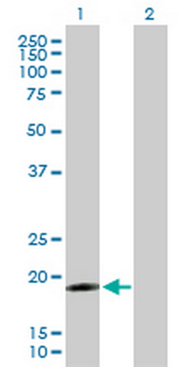 IFNA17 Antibody in Western Blot (WB)