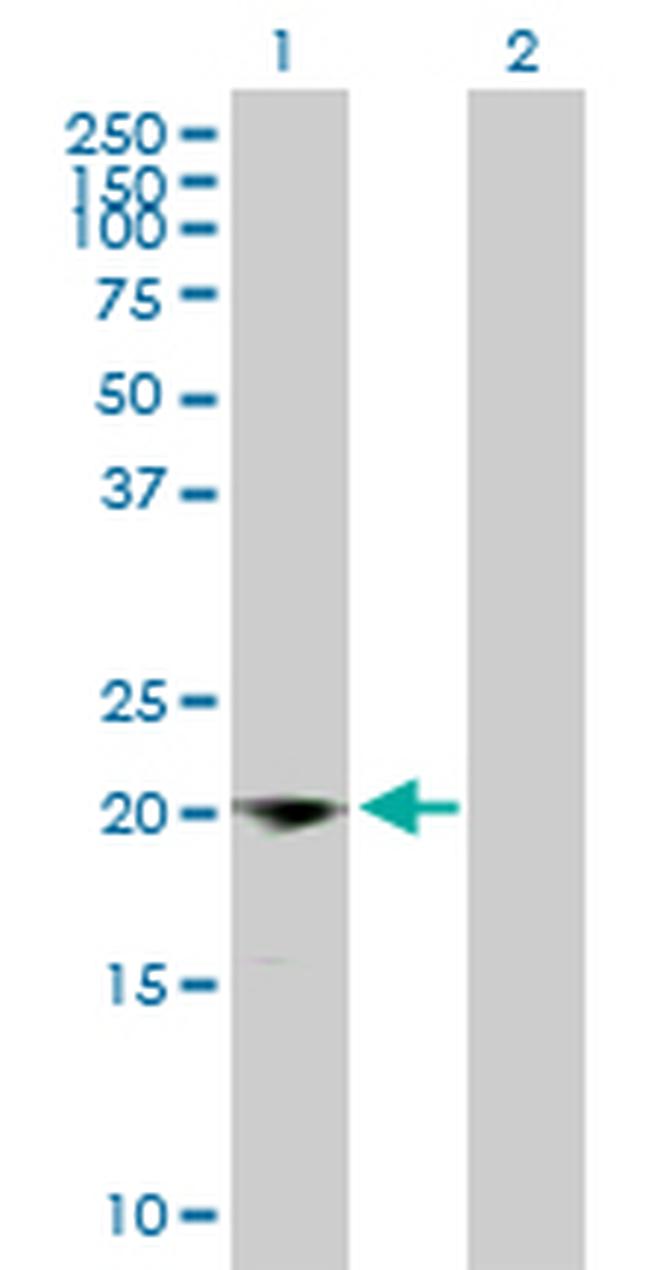 IFNG Antibody in Western Blot (WB)