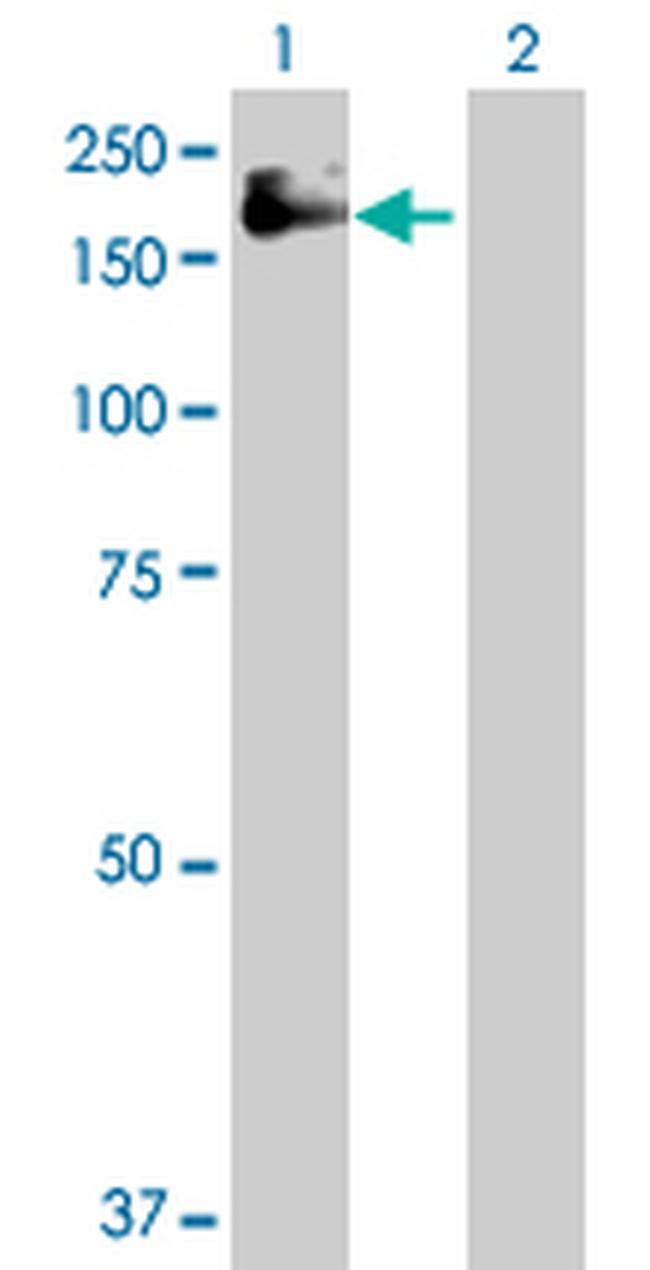 IGF1R Antibody in Western Blot (WB)