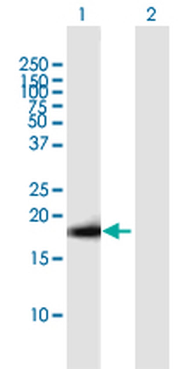 IGF2 Antibody in Western Blot (WB)
