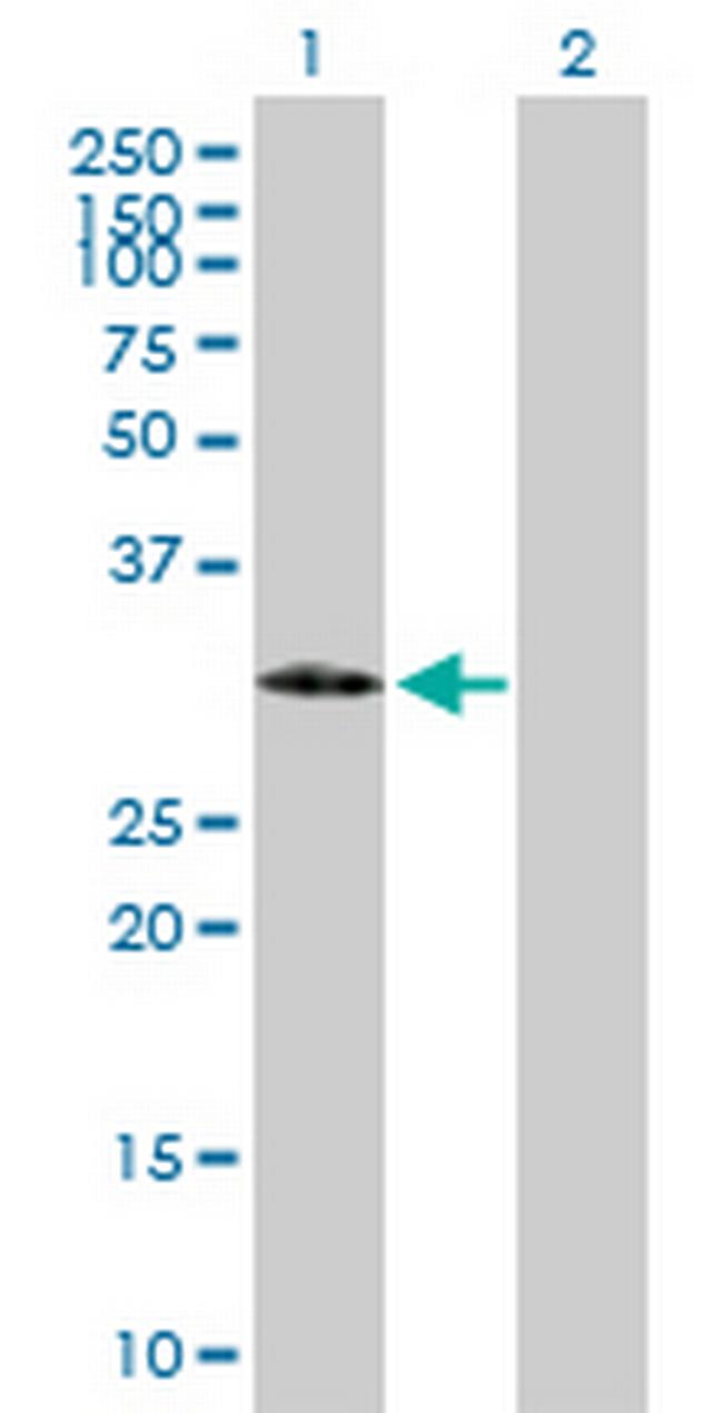 IGFBP2 Antibody in Western Blot (WB)