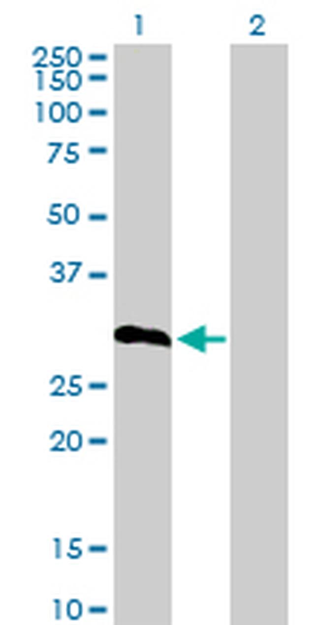 IGFBP6 Antibody in Western Blot (WB)