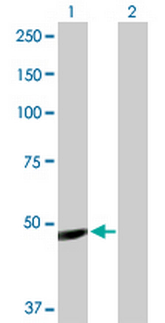 IGHG1 Antibody in Western Blot (WB)