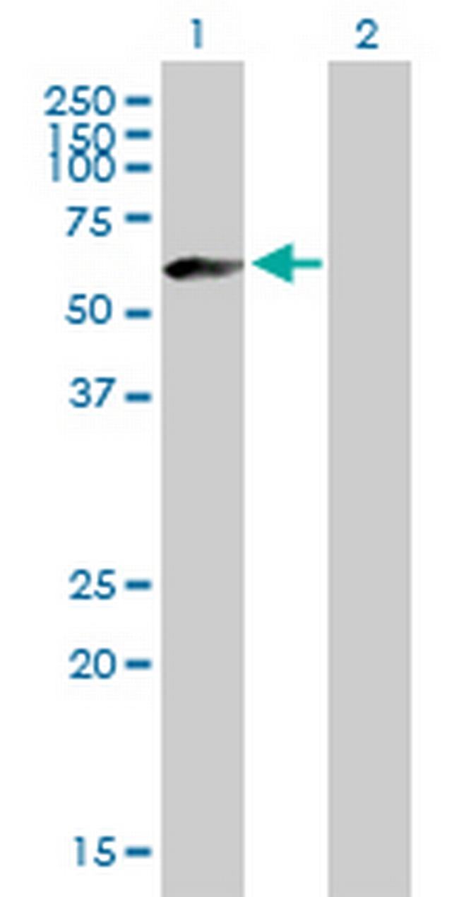 IGHM Antibody in Western Blot (WB)
