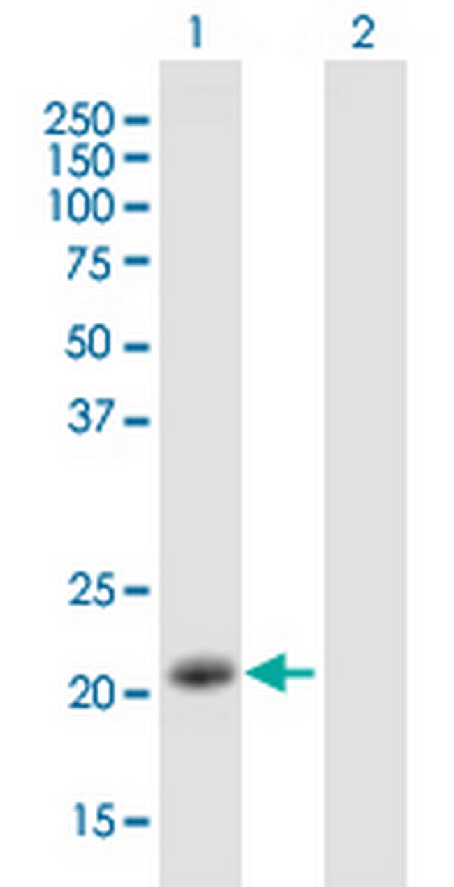IGJ Antibody in Western Blot (WB)