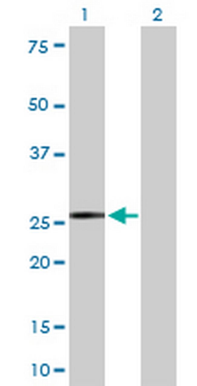 IGKC Antibody in Western Blot (WB)