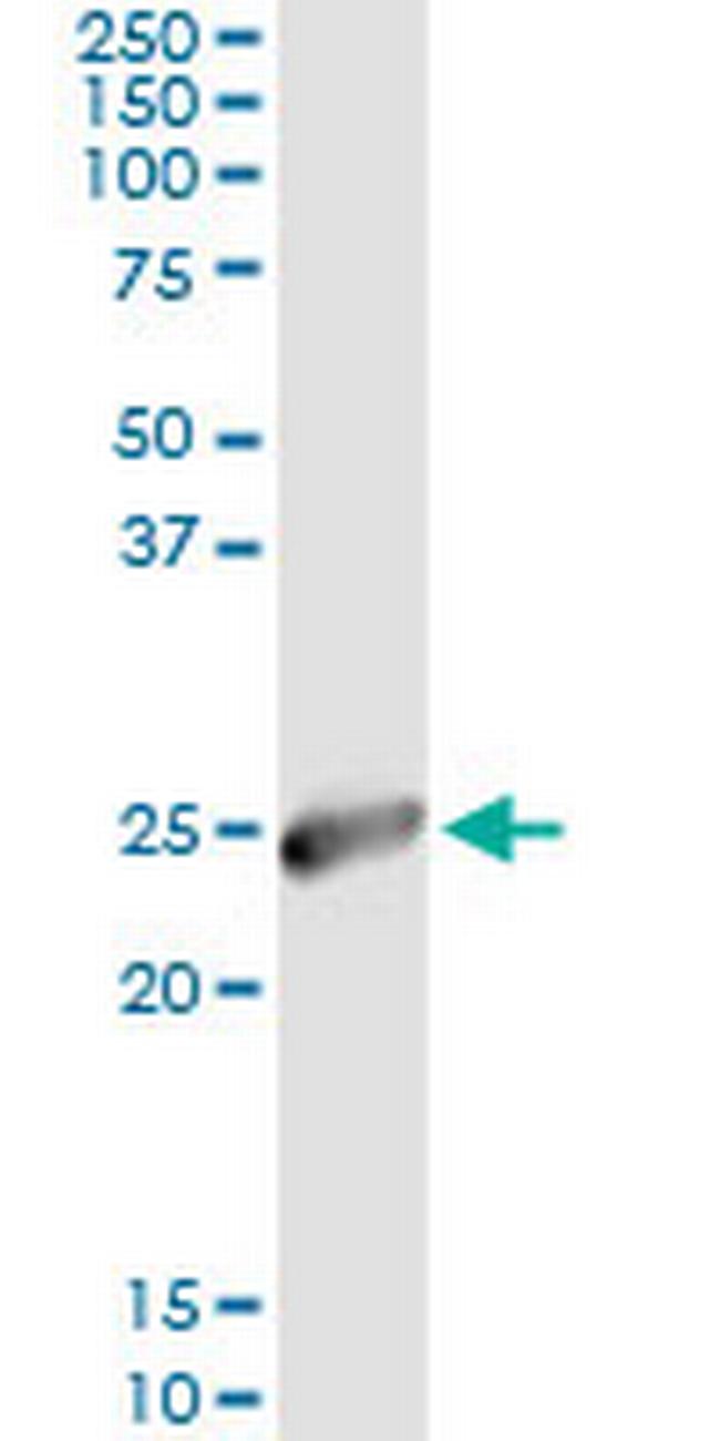 IGKC Antibody in Immunoprecipitation (IP)