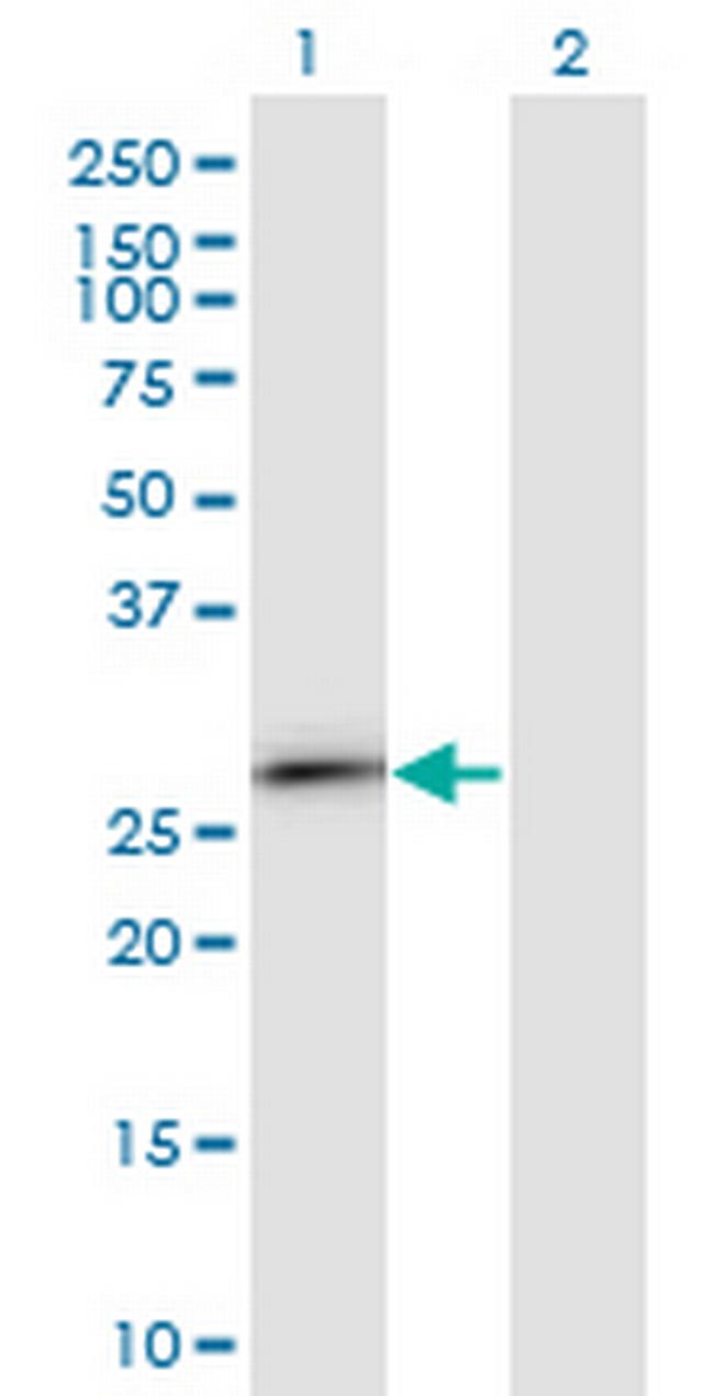 IGKC Antibody in Western Blot (WB)