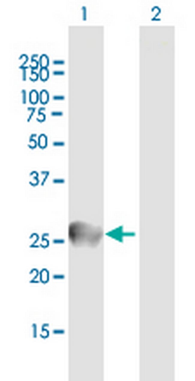 IGL Antibody in Western Blot (WB)