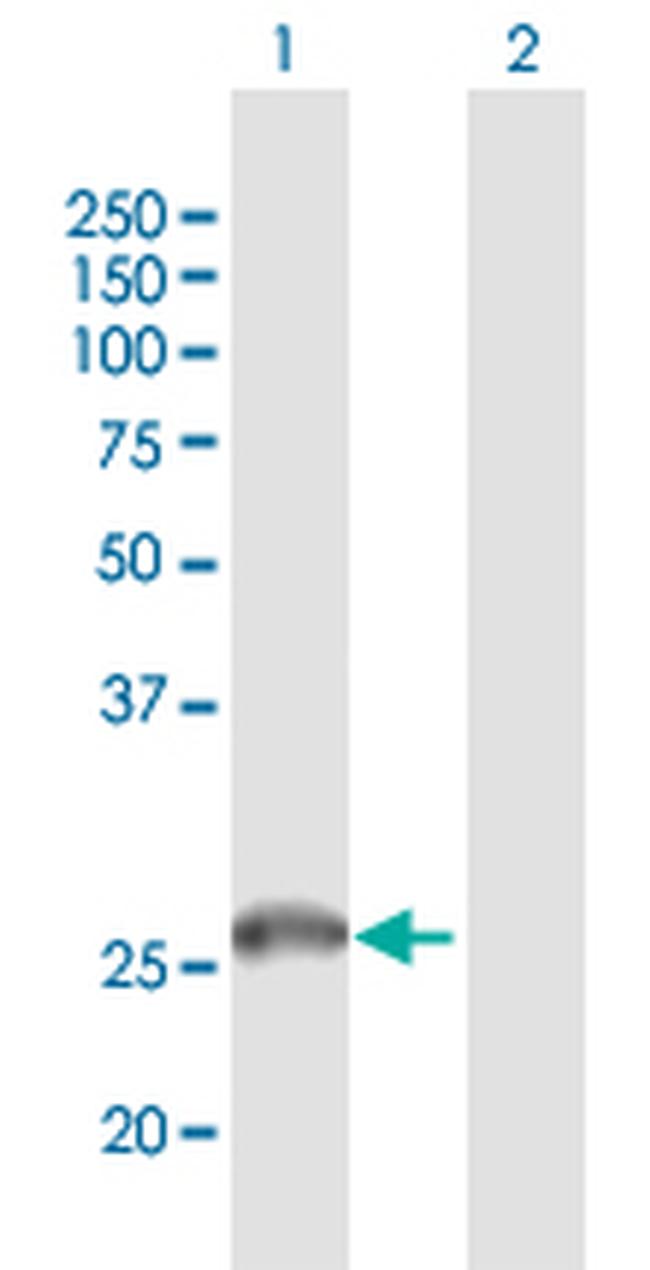 IGLC2 Antibody in Western Blot (WB)