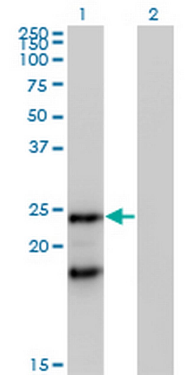 IGLL1 Antibody in Western Blot (WB)