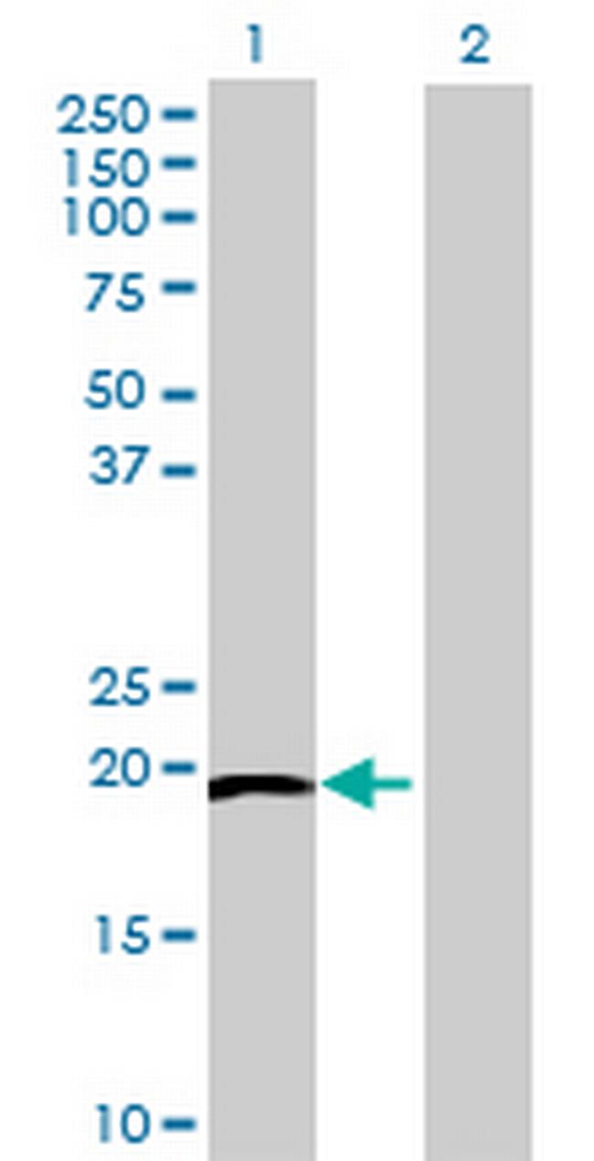 IGLL1 Antibody in Western Blot (WB)
