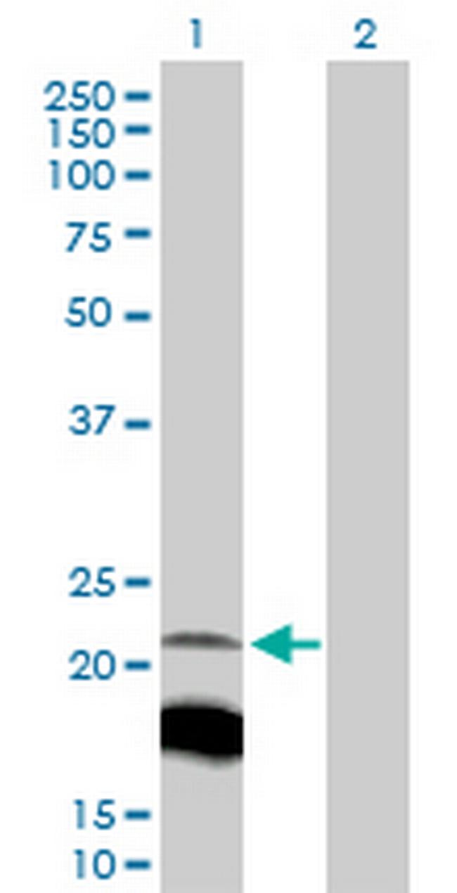IGLL1 Antibody in Western Blot (WB)