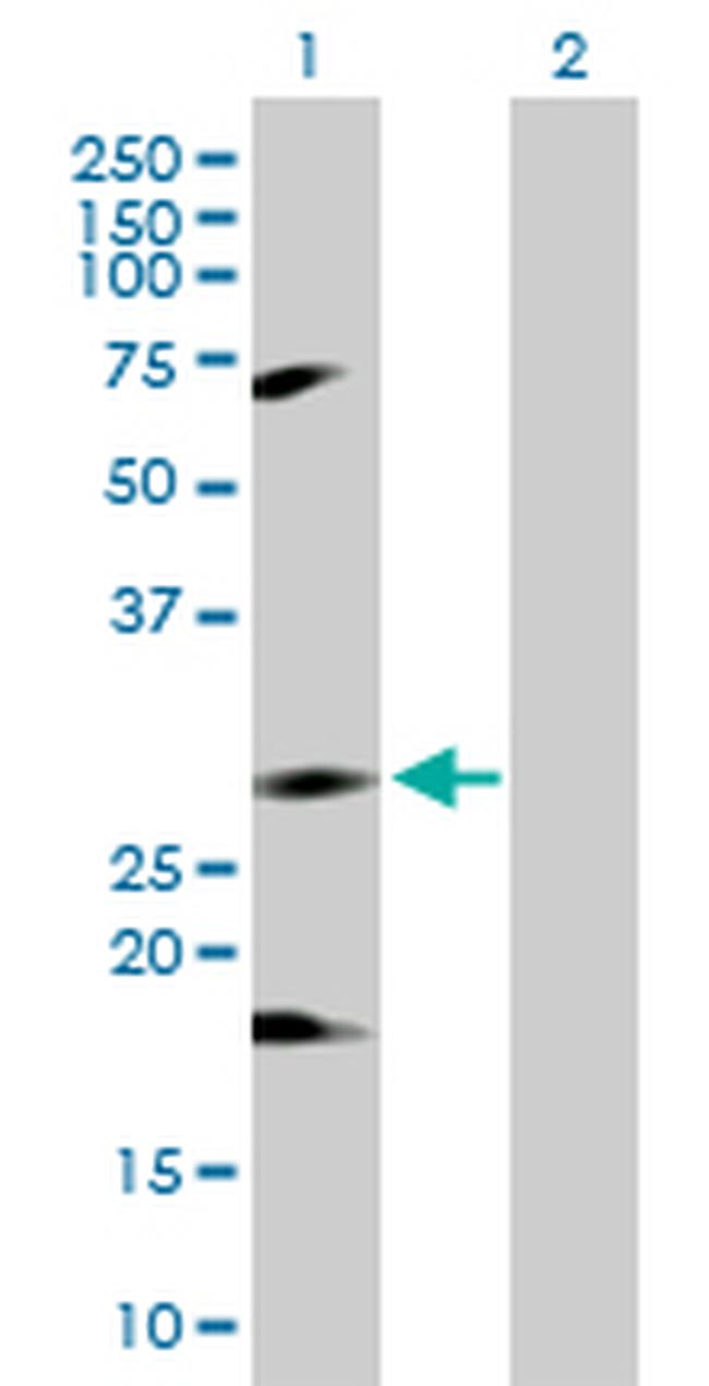 IKBKB Antibody in Western Blot (WB)