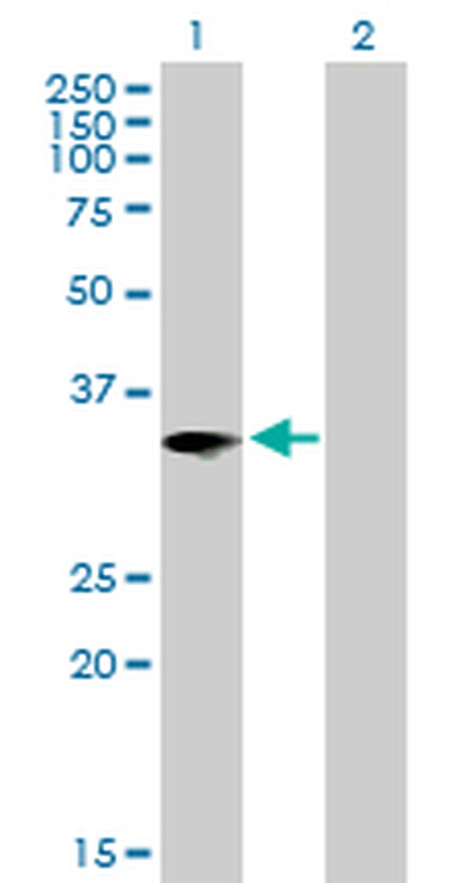IL1B Antibody in Western Blot (WB)