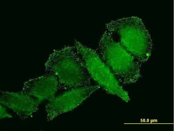 IL1B Antibody in Immunocytochemistry (ICC/IF)