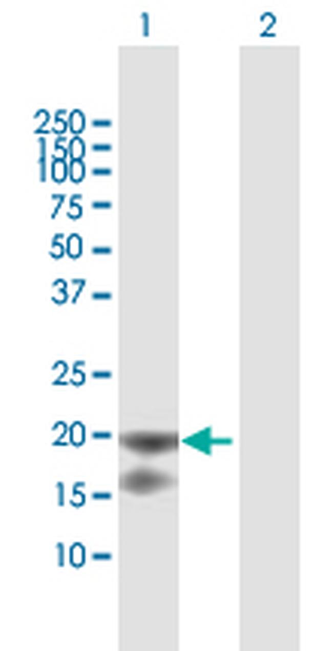 IL1RN Antibody in Western Blot (WB)
