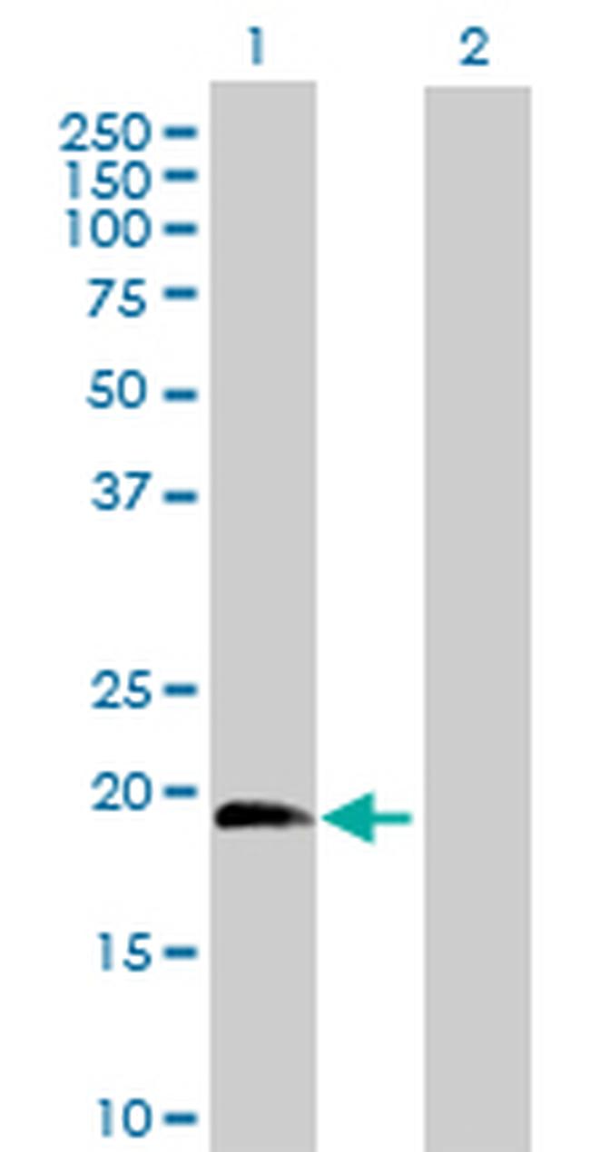 IL1RN Antibody in Western Blot (WB)
