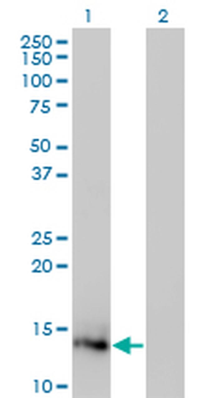 IL2 Antibody in Western Blot (WB)